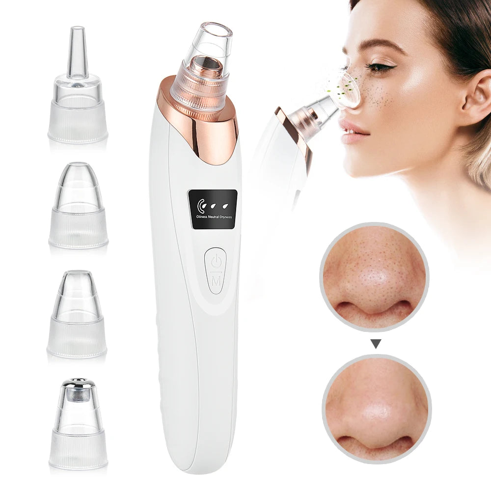 Electric Blackhead Remover Vacuum – Rechargeable Pore Cleaner